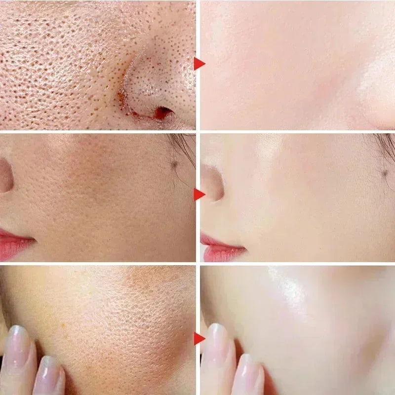 Suero Reductor de Poros con Ácido Láctico para Piel Suave y Reafirmante - Producto Reparador y Minimiza Poros para una Piel de Calidad Coreana
