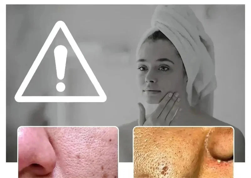 Suero Reductor de Poros con Ácido Láctico para Piel Suave y Reafirmante - Producto Reparador y Minimiza Poros para una Piel de Calidad Coreana