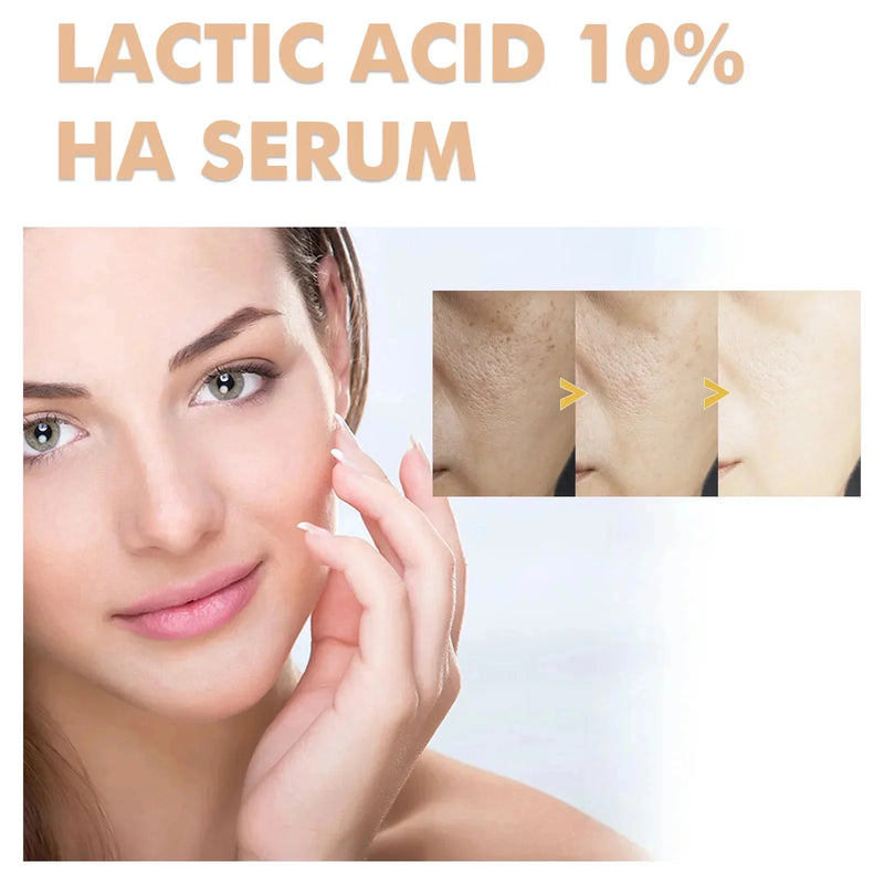 Suero Reductor de Poros con Ácido Láctico para Piel Suave y Reafirmante - Producto Reparador y Minimiza Poros para una Piel de Calidad Coreana
