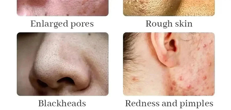 Suero Reductor de Poros con Ácido Láctico para Piel Suave y Reafirmante - Producto Reparador y Minimiza Poros para una Piel de Calidad Coreana