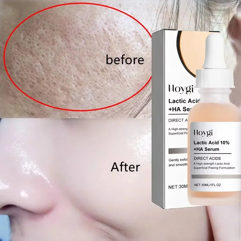 Suero Reductor de Poros con Ácido Láctico para Piel Suave y Reafirmante - Producto Reparador y Minimiza Poros para una Piel de Calidad Coreana