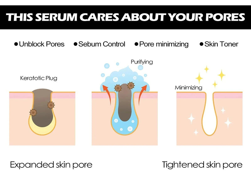 Suero Reductor de Poros con Ácido Láctico para Piel Suave y Reafirmante - Producto Reparador y Minimiza Poros para una Piel de Calidad Coreana