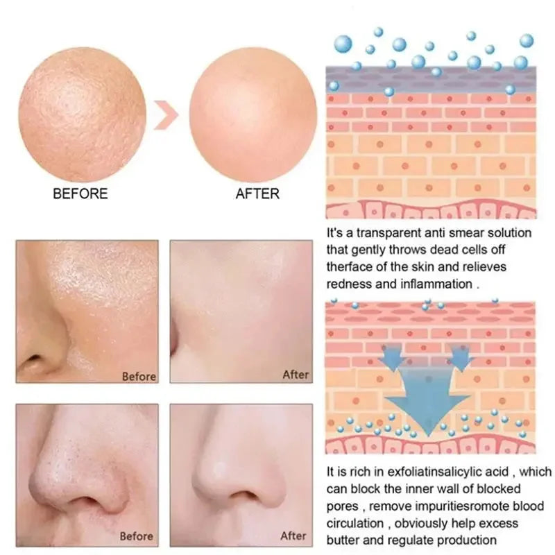 Suero Reductor de Poros con Ácido Láctico para Piel Suave y Reafirmante - Producto Reparador y Minimiza Poros para una Piel de Calidad Coreana