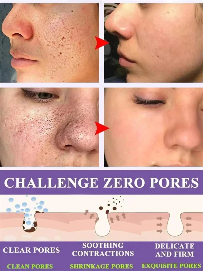 Suero Reductor de Poros con Ácido Láctico para Piel Suave y Reafirmante - Producto Reparador y Minimiza Poros para una Piel de Calidad Coreana